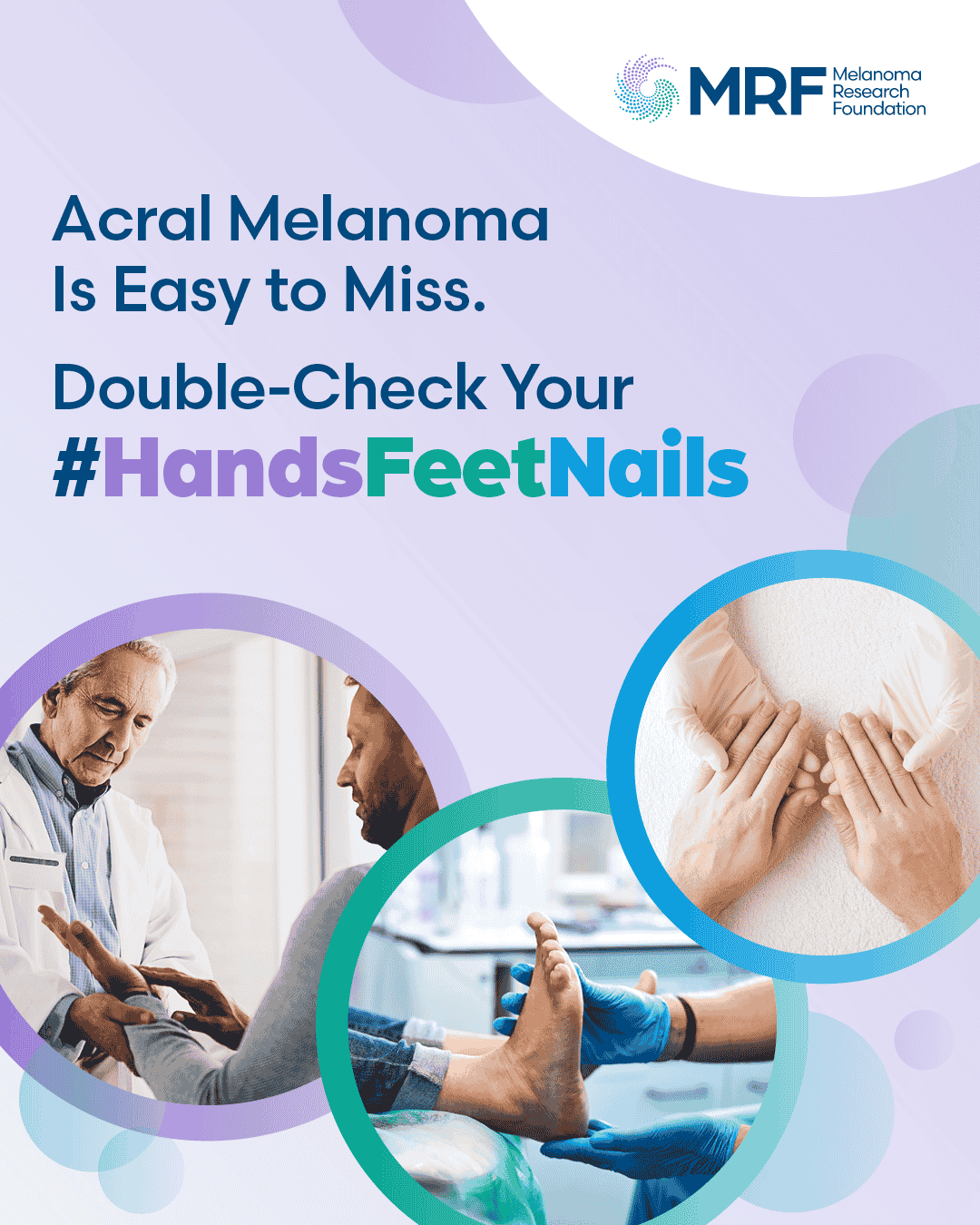 Acral Melanoma Awareness Week